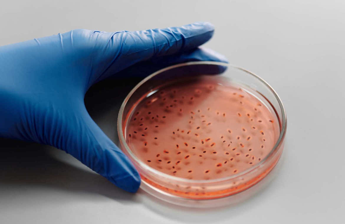 What Happens in Our Body in the Absence of Akkermansia Muciniphila?